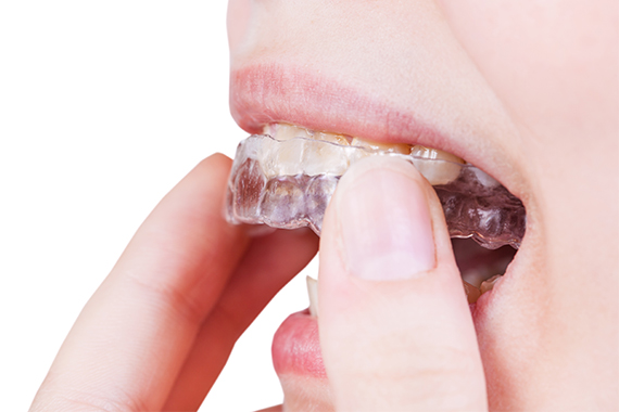 歯周病を予防する3DS